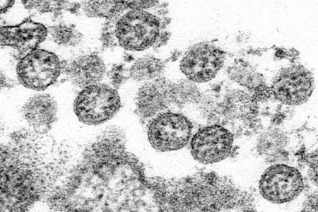 US investigates latest case of a rare tropical disease