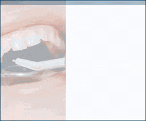Modern Dentistry Fall Ads GIF 300x250 px
